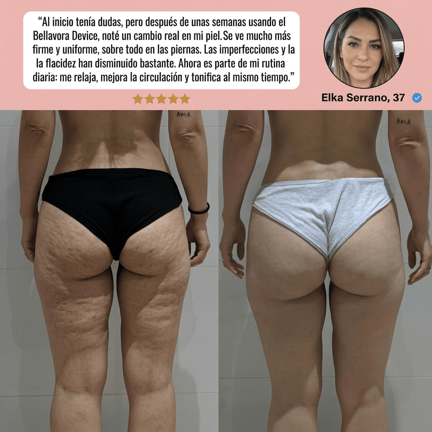 Masajeador anticelulitis con calor y succión