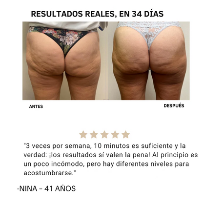 Reduce celulitis en semanas | Masajeador-Anticelulitis™