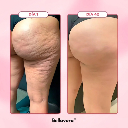 Masajeador anticelulitis