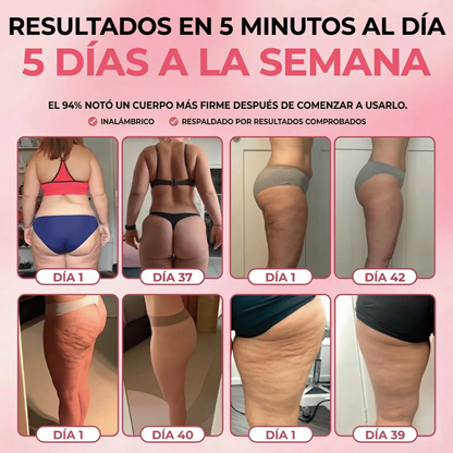 Masajeador anticelulitis con calor y succión