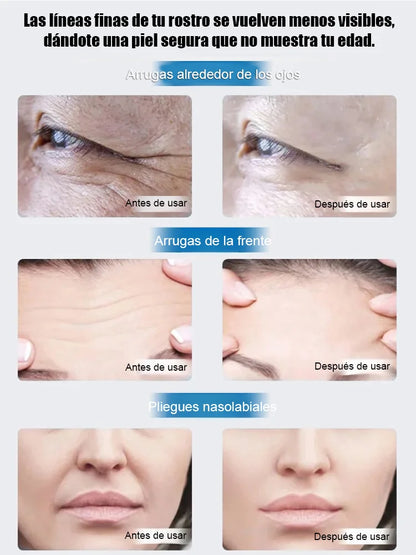 Suero antienvejecimiento rejuvenecedor