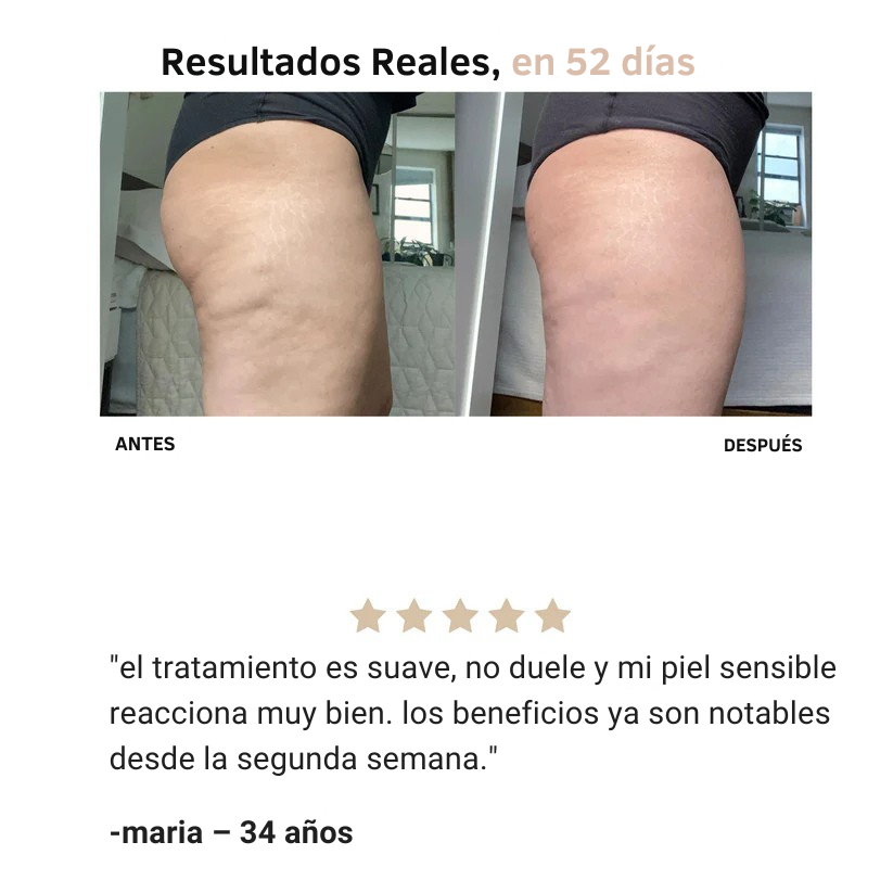 Reduce celulitis en semanas | Masajeador-Anticelulitis™
