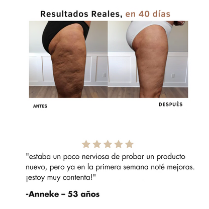 Reduce celulitis en semanas | Masajeador-Anticelulitis™
